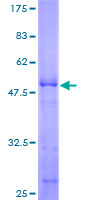 AKIRIN2 Protein - 12.5% SDS-PAGE of human C6orf166 stained with Coomassie Blue