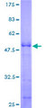 AKIRIN2 Protein - 12.5% SDS-PAGE of human C6orf166 stained with Coomassie Blue