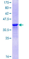 AKNA / KIAA1968 Protein - 12.5% SDS-PAGE Stained with Coomassie Blue.