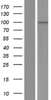 AKNAD1 Protein - Western validation with an anti-DDK antibody * L: Control HEK293 lysate R: Over-expression lysate