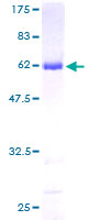 AKR1A1 Protein - 12.5% SDS-PAGE of human AKR1A1 stained with Coomassie Blue