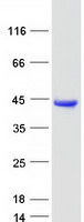 AKR1A1 Protein - Purified recombinant protein AKR1A1 was analyzed by SDS-PAGE gel and Coomassie Blue Staining