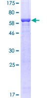 AKR1B1 / Aldose Reductase Protein - 12.5% SDS-PAGE of human AKR1B1 stained with Coomassie Blue