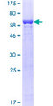 AKR1B1 / Aldose Reductase Protein - 12.5% SDS-PAGE of human AKR1B1 stained with Coomassie Blue
