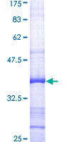 AKR1B1 / Aldose Reductase Protein - 12.5% SDS-PAGE Stained with Coomassie Blue.