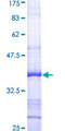 AKR1B1 / Aldose Reductase Protein - 12.5% SDS-PAGE Stained with Coomassie Blue.