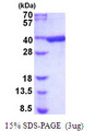 AKR1B1 / Aldose Reductase Protein