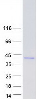 AKR1B1 / Aldose Reductase Protein - Purified recombinant protein AKR1B1 was analyzed by SDS-PAGE gel and Coomassie Blue Staining