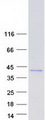 AKR1B1 / Aldose Reductase Protein - Purified recombinant protein AKR1B1 was analyzed by SDS-PAGE gel and Coomassie Blue Staining