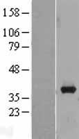 AKR1B10 Protein - Western validation with an anti-DDK antibody * L: Control HEK293 lysate R: Over-expression lysate