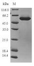 AKR1B10 Protein - (Tris-Glycine gel) Discontinuous SDS-PAGE (reduced) with 5% enrichment gel and 15% separation gel.