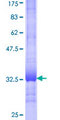 AKR1B10 Protein - 12.5% SDS-PAGE Stained with Coomassie Blue.