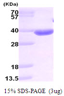 AKR1B10 Protein