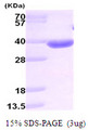 AKR1B10 Protein