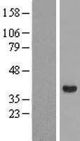 AKR1C4 / Chlordecone Reductase Protein - Western validation with an anti-DDK antibody * L: Control HEK293 lysate R: Over-expression lysate