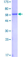 AKR1C4 / Chlordecone Reductase Protein - 12.5% SDS-PAGE of human AKR1C4 stained with Coomassie Blue