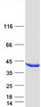 AKR1C4 / Chlordecone Reductase Protein - Purified recombinant protein AKR1C4 was analyzed by SDS-PAGE gel and Coomassie Blue Staining