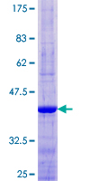 AKR1C8P / AKR1CL1 Protein