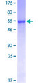 AKR1D1 Protein - 12.5% SDS-PAGE of human AKR1D1 stained with Coomassie Blue