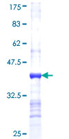 AKR1D1 Protein - 12.5% SDS-PAGE Stained with Coomassie Blue.