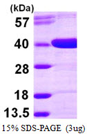 AKR1D1 Protein