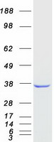 AKR1D1 Protein - Purified recombinant protein AKR1D1 was analyzed by SDS-PAGE gel and Coomassie Blue Staining