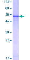 AKR1E2 Protein - 12.5% SDS-PAGE of human AKR1CL2 stained with Coomassie Blue