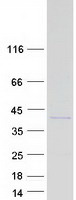 AKR1E2 Protein - Purified recombinant protein AKR1E2 was analyzed by SDS-PAGE gel and Coomassie Blue Staining