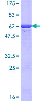 AKR7A2 / AFAR Protein - 12.5% SDS-PAGE of human AKR7A2 stained with Coomassie Blue