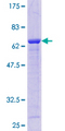 AKR7A2 / AFAR Protein - 12.5% SDS-PAGE of human AKR7A2 stained with Coomassie Blue