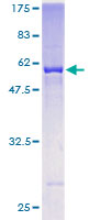 AKR7A3 Protein - 12.5% SDS-PAGE of human AKR7A3 stained with Coomassie Blue