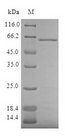 AKR7A3 Protein - (Tris-Glycine gel) Discontinuous SDS-PAGE (reduced) with 5% enrichment gel and 15% separation gel.