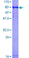 AKT1 Protein - 12.5% SDS-PAGE of human AKT1 stained with Coomassie Blue