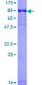 AKT1 Protein - 12.5% SDS-PAGE of human AKT1 stained with Coomassie Blue