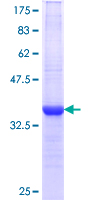 AKT1 Protein - 12.5% SDS-PAGE Stained with Coomassie Blue.