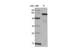 AKT1 Protein - Recombinant Human pan-AKT protein (His Tag)