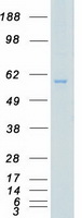 AKT1 Protein - Purified recombinant protein AKT1 was analyzed by SDS-PAGE gel and Coomassie Blue Staining