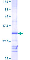 AKT2 Protein - 12.5% SDS-PAGE Stained with Coomassie Blue.