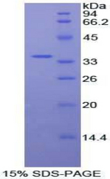 AKT2 Protein - Recombinant Protein Kinase B Beta By SDS-PAGE