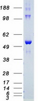 AKT2 Protein - Purified recombinant protein AKT2 was analyzed by SDS-PAGE gel and Coomassie Blue Staining