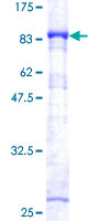 AKT3 Protein - 12.5% SDS-PAGE of human AKT3 stained with Coomassie Blue