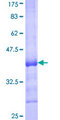 AKT3 Protein - 12.5% SDS-PAGE Stained with Coomassie Blue.