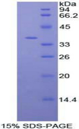 AKT3 Protein - Recombinant Protein Kinase B Gamma By SDS-PAGE
