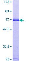 ALAD Protein - 12.5% SDS-PAGE of human ALAD stained with Coomassie Blue