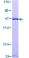 ALAD Protein - 12.5% SDS-PAGE of human ALAD stained with Coomassie Blue