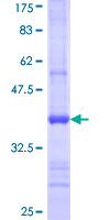 ALAD Protein - 12.5% SDS-PAGE Stained with Coomassie Blue.