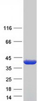 ALAD Protein - Purified recombinant protein ALAD was analyzed by SDS-PAGE gel and Coomassie Blue Staining