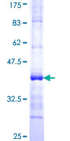 ALAS1 Protein - 12.5% SDS-PAGE Stained with Coomassie Blue.