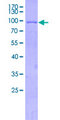 ALAS2 Protein - 12.5% SDS-PAGE of human ALAS2 stained with Coomassie Blue