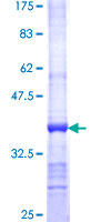 ALAS2 Protein - 12.5% SDS-PAGE Stained with Coomassie Blue.